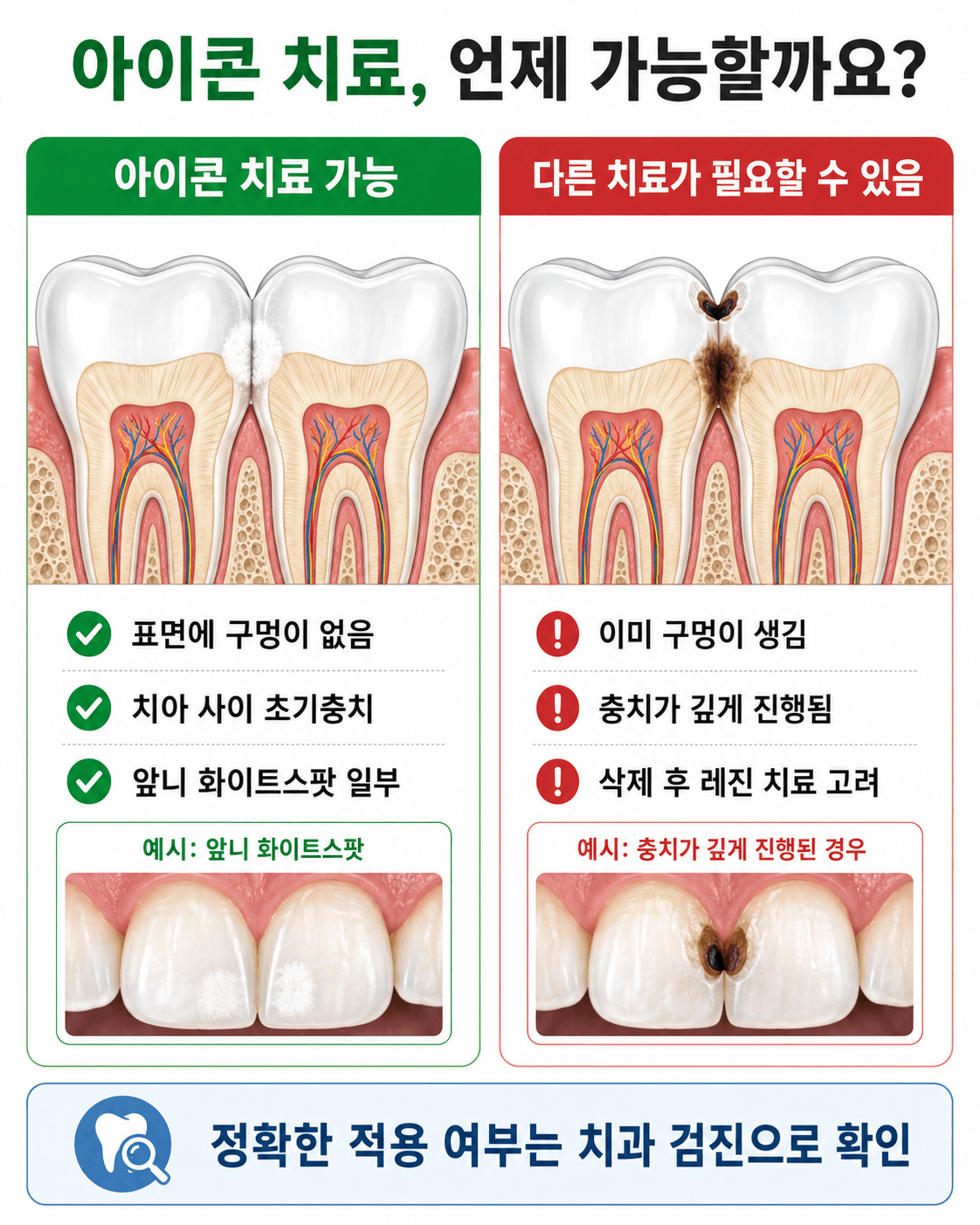 아이콘치료 가능한 경우와 불가능한 경우