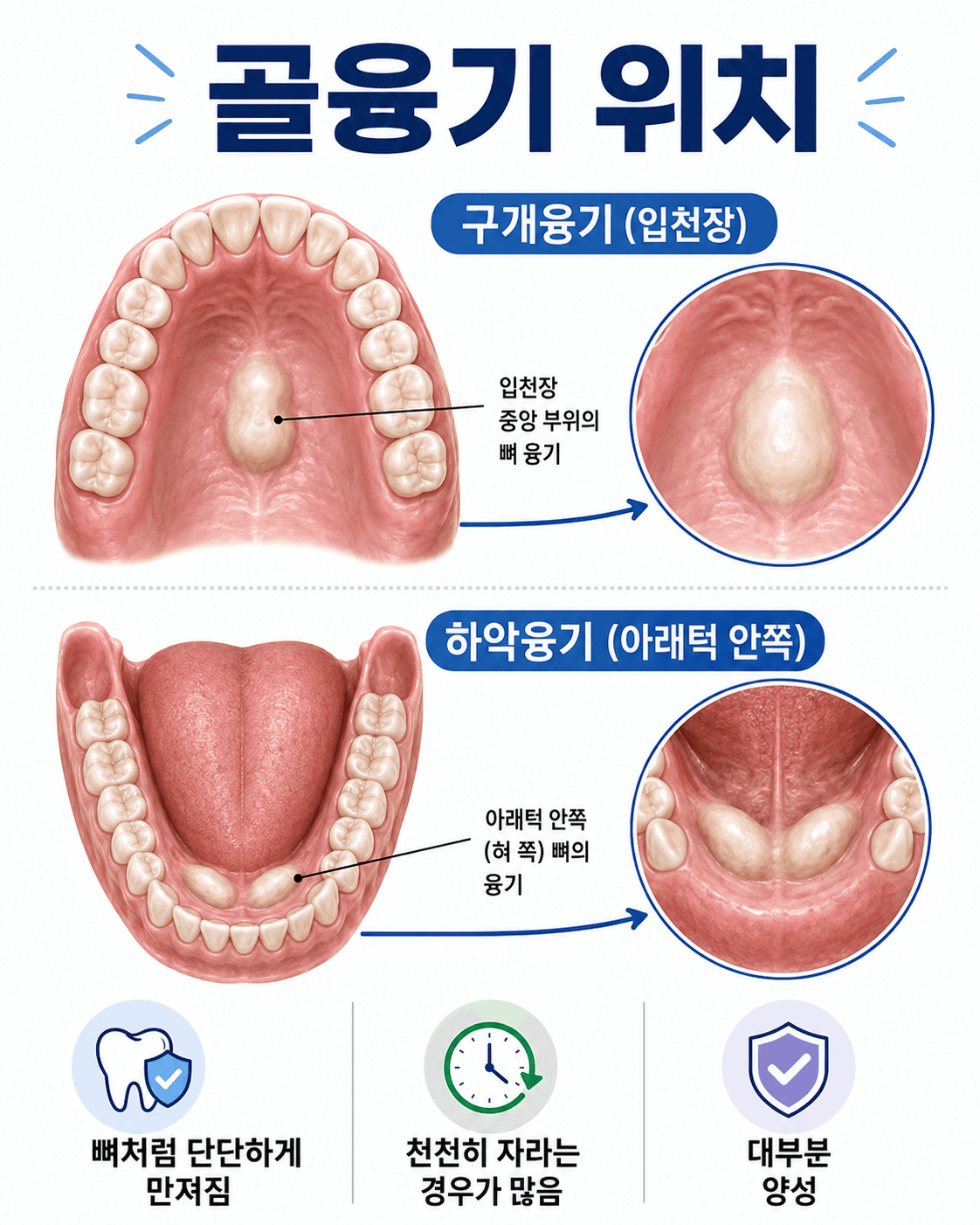 골융기위치