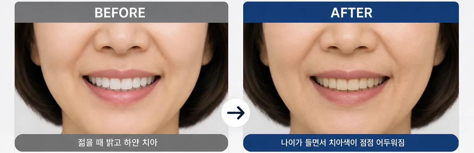 나이들수록 어두워지는 치아